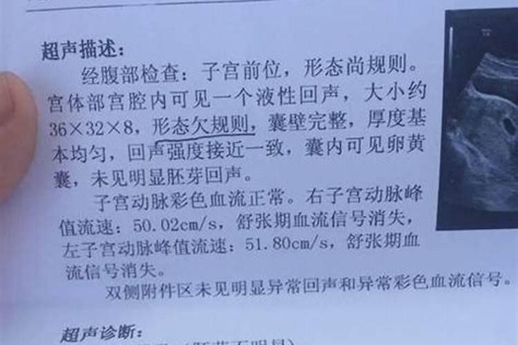 梦到被抢劫什么预兆发生打斗