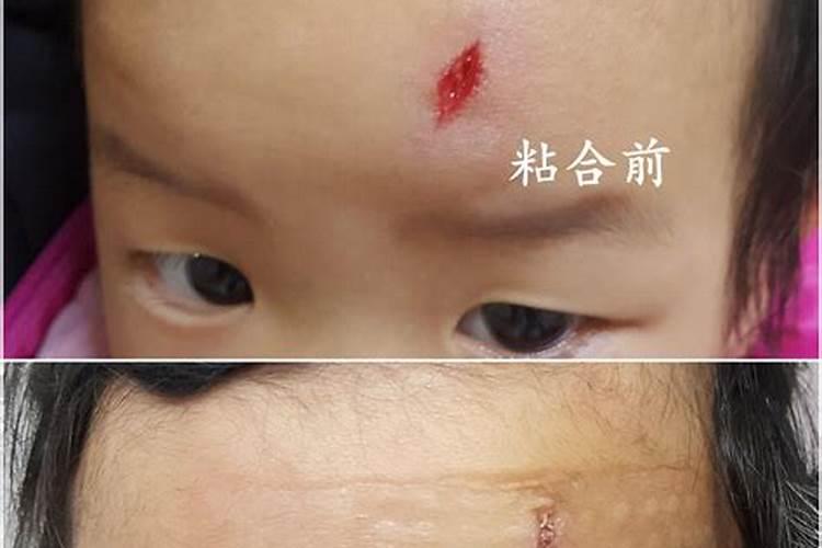 梦见妈妈缺胳膊少腿