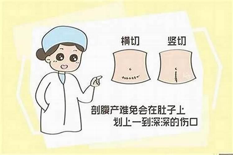 剖腹产的怎么看生辰八字