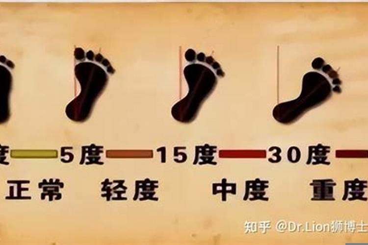 外八字脚走路的人好不好