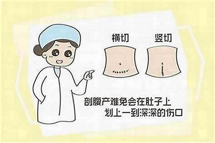 剖腹产的孩子命理