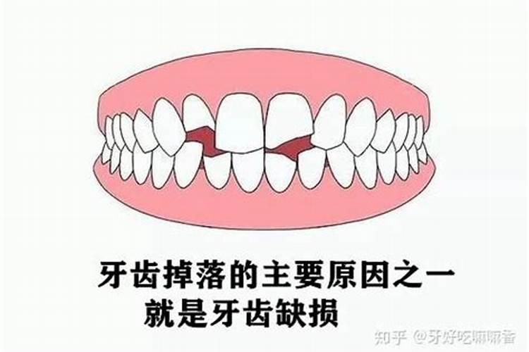 梦到牙齿全部脱落了吐出来一大把血块